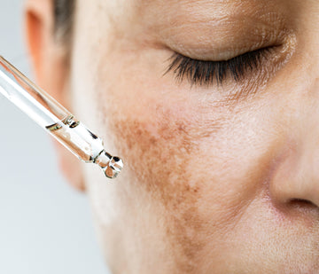 Close-up of a woman's face with a skin concern being addressed by a skincare tool.